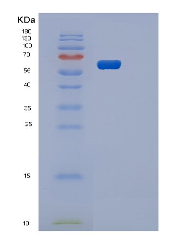 Human OXSR1 (Serine/Threonine-Protein Kinase Osr1) - Recombinant Protein