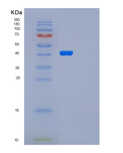 Human PARP2 (Poly [Adp-Ribose] Polymerase 2) - Recombinant Protein