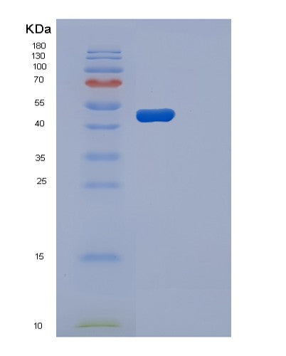 Human PGK2 (Phosphoglycerate Kinase 2) - Recombinant Protein