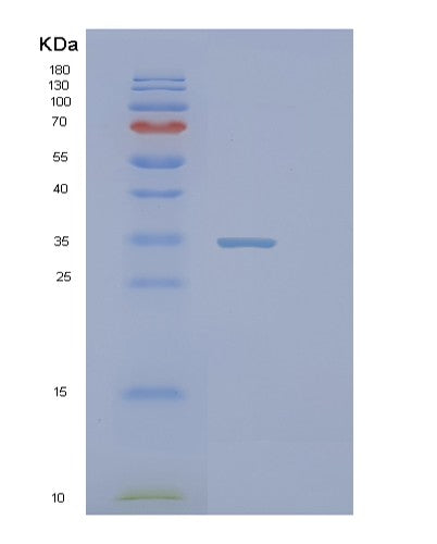 Human PIH1D1 (Pih1 Domain-Containing Protein 1) - Recombinant Protein