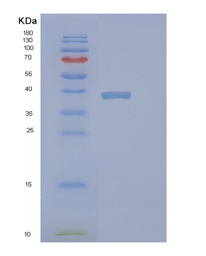 Human PINX1 (Pin2/Terf1-Interacting Telomerase Inhibitor 1) - Recombinant Protein
