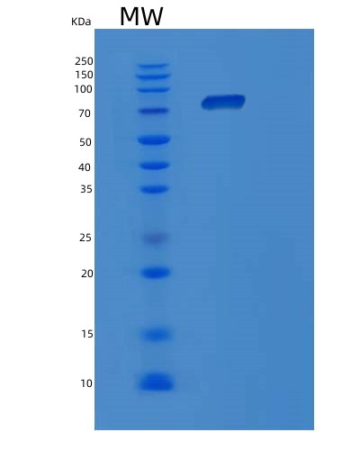 Human POR (Nadph--Cytochrome P450 Reductase) - Recombinant Protein