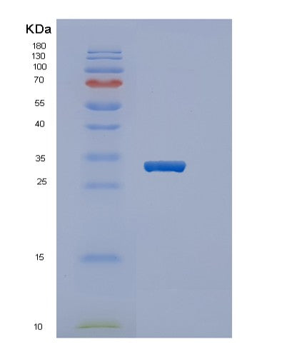 Human PPARG (Peroxisome Proliferator-Activated Receptor Gamma) - Recombinant Protein