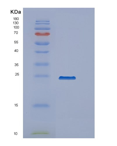Human PPCDC (Phosphopantothenoylcysteine Decarboxylase) - Recombinant Protein