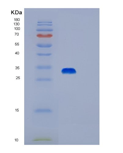 Human PRKAB2 (5'-Amp-Activated Protein Kinase Subunit Beta-2) - Recombinant Protein