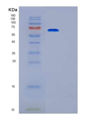 Human PRKACA (Camp-Dependent Protein Kinase Catalytic Subunit Alpha) - Recombinant Protein