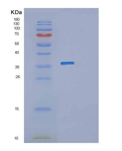 Human PRKRA (Interferon-Inducible Double-Stranded Rna-Dependent Protein Kinase Activator A) - Recombinant Protein
