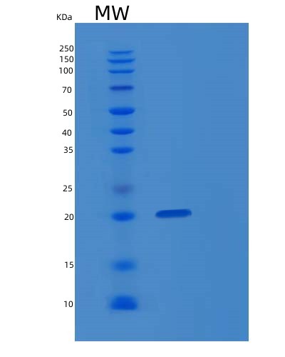 Human PTGDS (Prostaglandin-H2 D-Isomerase) - Recombinant Protein