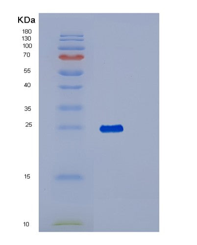 Human RAB1B (Ras-Related Protein Rab-1B) - Recombinant Protein
