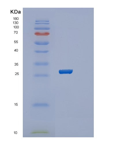 Human RAB39B (Ras-Related Protein Rab-39B) - Recombinant Protein