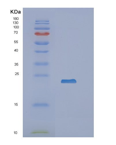 Human RBP4 (Retinol-Binding Protein 4) - Recombinant Protein