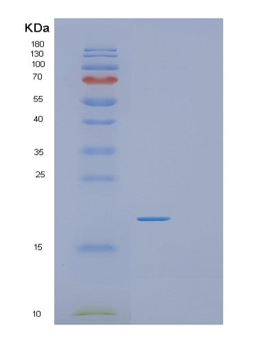 Human RGS21 (Regulator Of G-Protein Signaling 21) - Recombinant Protein