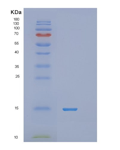Human RNF7 (Ring-Box Protein 2) - Recombinant Protein
