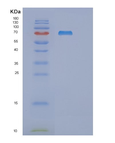 Human RNGTT (Mrna-Capping Enzyme) - Recombinant Protein