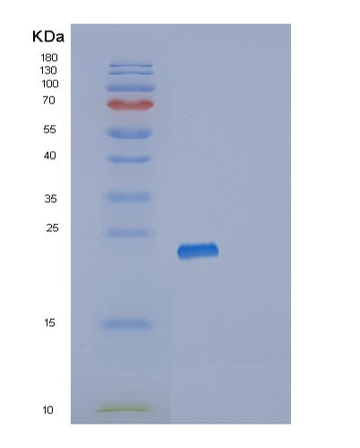 Human RPL11 (Large Ribosomal Subunit Protein Ul5) - Recombinant Protein