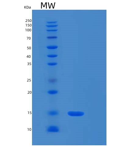 Human RPL30 (Large Ribosomal Subunit Protein El30) - Recombinant Protein