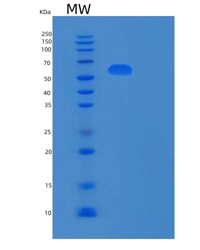 Human RPN2 (Dolichyl-Diphosphooligosaccharide--Protein Glycosyltransferase Subunit 2) - Recombinant Protein