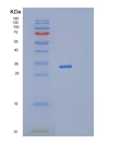 Human RWDD1 (Rwd Domain-Containing Protein 1) - Recombinant Protein