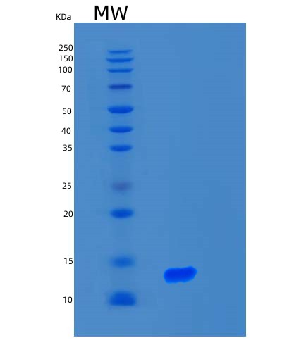 Human S100A2 (Protein S100-A2) - Recombinant Protein