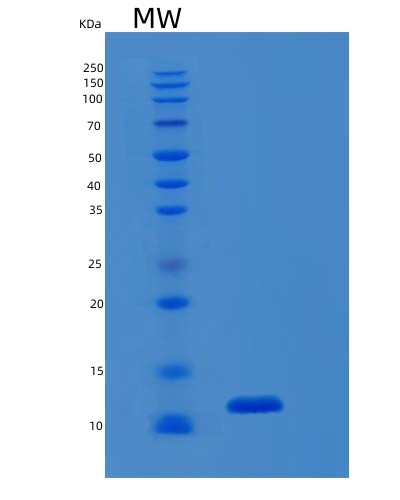 Human S100B (Protein S100-B) - Recombinant Protein