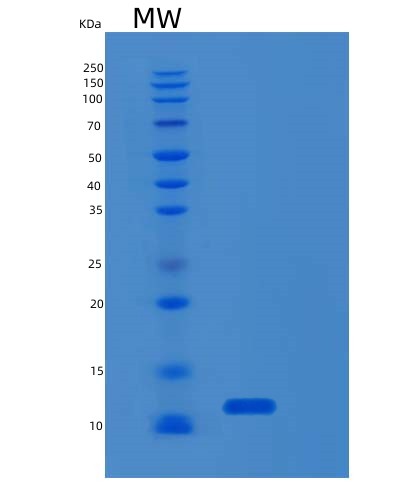 Mouse S100b (Protein S100-B) - Recombinant Protein