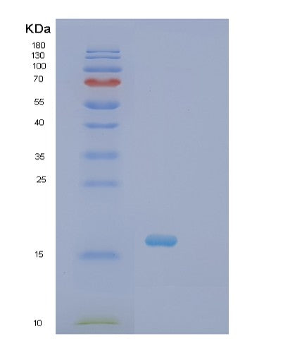 Human SCN3B (Sodium Channel Regulatory Subunit Beta-3) - Recombinant Protein