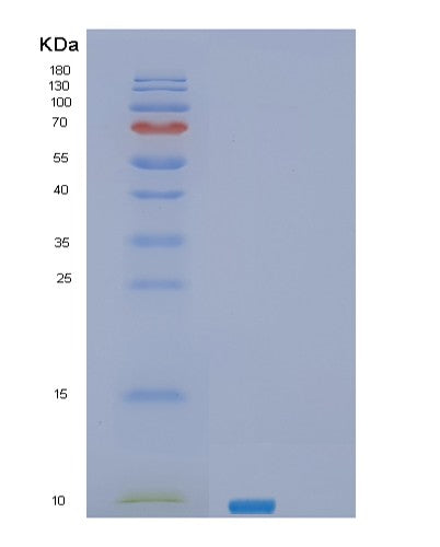 Human SEC61B (Protein Transport Protein Sec61 Subunit Beta) - Recombinant Protein