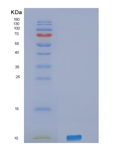 Human SELPLG (P-Selectin Glycoprotein Ligand 1) - Recombinant Protein