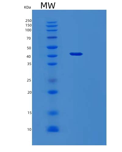 Human SEPTIN3 (Neuronal-Specific Septin-3) - Recombinant Protein