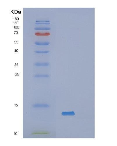 Human SAA1 (Serum Amyloid A-1 Protein) - Recombinant Protein
