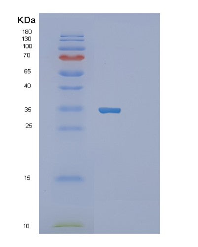 Human SFRP2 (Secreted Frizzled-Related Protein 2) - Recombinant Protein