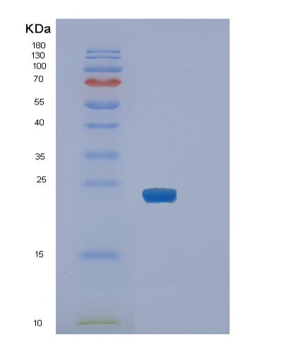 Human SLAMF7 (Slam Family Member 7) - Recombinant Protein