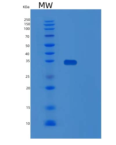 Human SPRY4 (Protein Sprouty Homolog 4) - Recombinant Protein