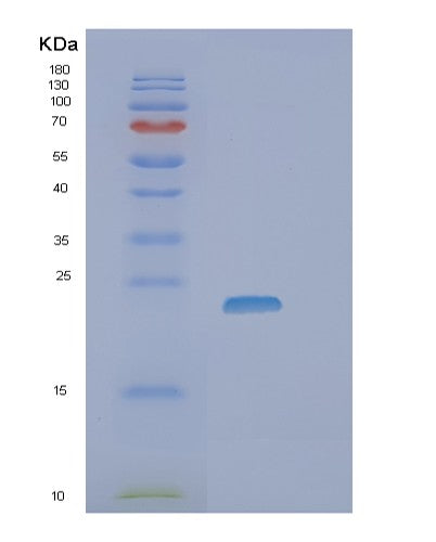 Human ZNRD2 (Protein Znrd2) - Recombinant Protein