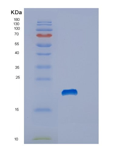 Human STMN1 (Stathmin) - Recombinant Protein
