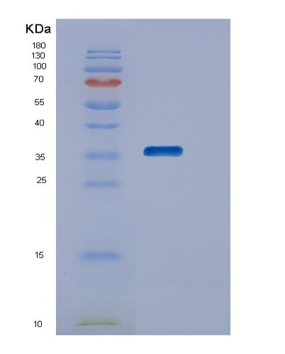 Human STK16 (Serine/Threonine-Protein Kinase 16) - Recombinant Protein
