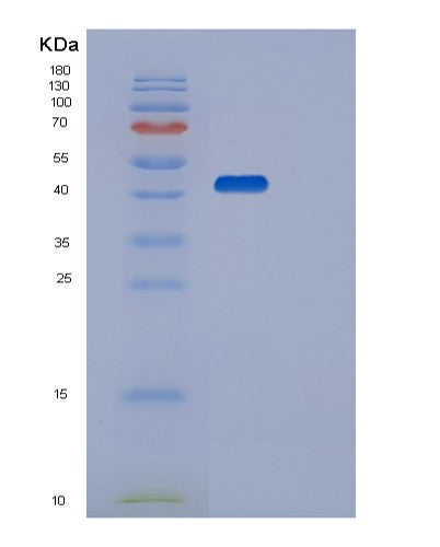Human STK17B (Serine/Threonine-Protein Kinase 17B) - Recombinant Protein