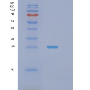 Human STXBP6 (Syntaxin-Binding Protein 6) - Recombinant Protein
