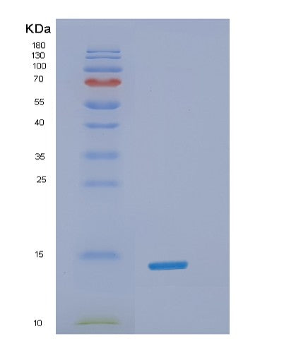 Human SNCA (Alpha-Synuclein) - Recombinant Protein