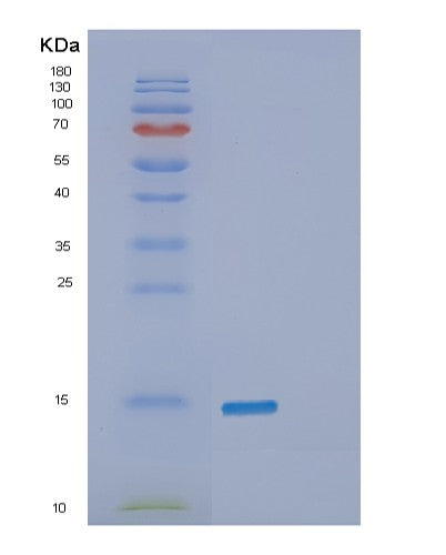 Human SNCB (Beta-Synuclein) - Recombinant Protein