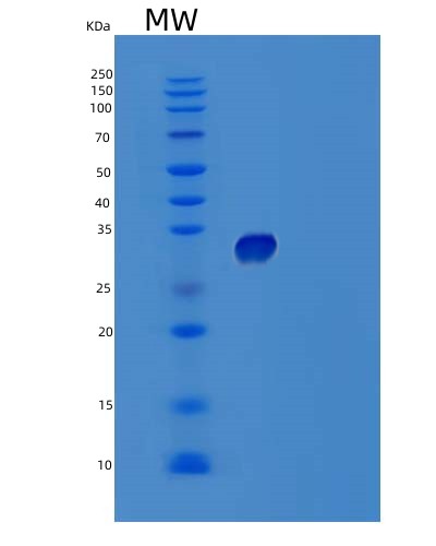 Human TNFRSF6B (Tumor Necrosis Factor Receptor Superfamily Member 6B) - Recombinant Protein