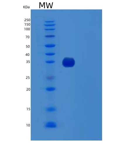 Human TTC1 (Tetratricopeptide Repeat Protein 1) - Recombinant Protein