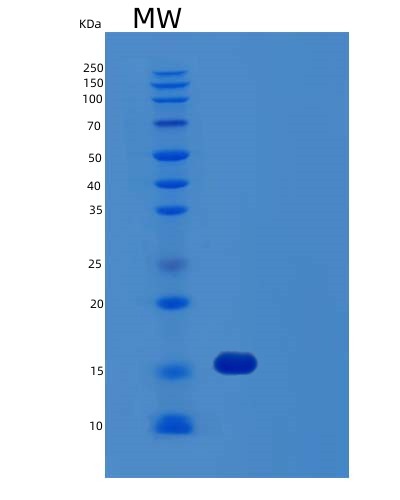 Human FIS1 (Mitochondrial Fission 1 Protein) - Recombinant Protein