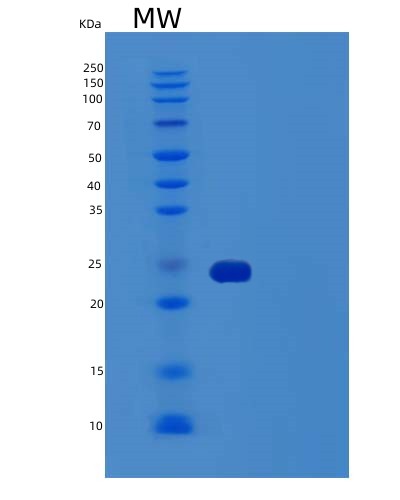 Human TNFRSF1B (Tumor Necrosis Factor Receptor Superfamily Member 1B) - Recombinant Protein