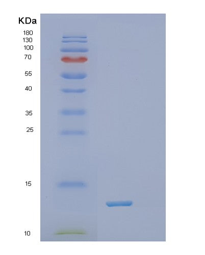 Human TXN (Thioredoxin) - Recombinant Protein