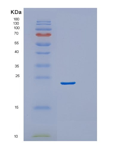 Human VEGFA (Vascular Endothelial Growth Factor A, Long Form) - Recombinant Protein