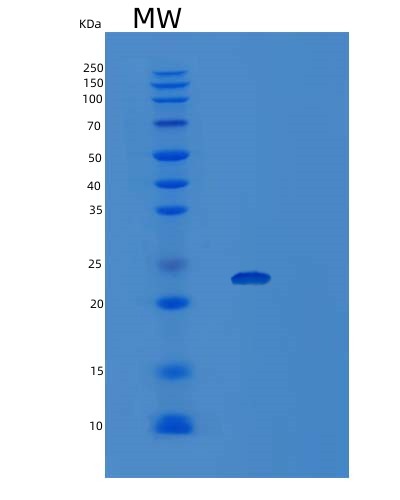 Human VPS29 (Vacuolar Protein Sorting-Associated Protein 29) - Recombinant Protein