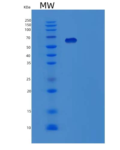 Human YARS1 (Tyrosine--Trna Ligase, Cytoplasmic) - Recombinant Protein