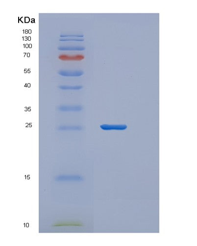 Human ZFAND5 (An1-Type Zinc Finger Protein 5) - Recombinant Protein