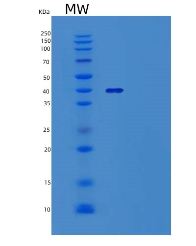 Human ABAT (4-Aminobutyrate Aminotransferase, Mitochondrial) - Recombinant Protein